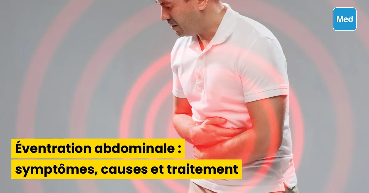  Éventration abdominale : symptômes, causes et traitement